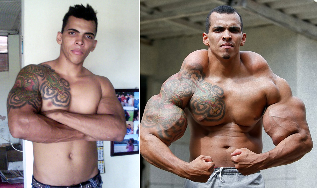 Synthol Leaking