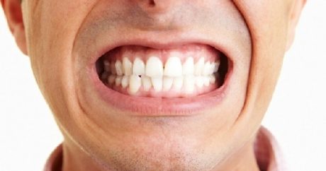 Diş qıcamasının qorxunc fəsadları – SİYAHI