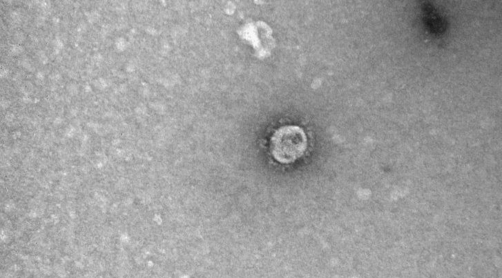 Bu da koronavirusun şəkli – FOTOLAR