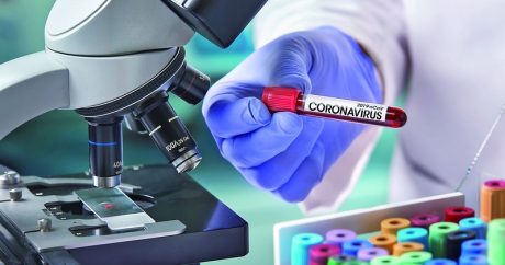 Türkiyədə daha 289 nəfər koronavirusa yoluxdu