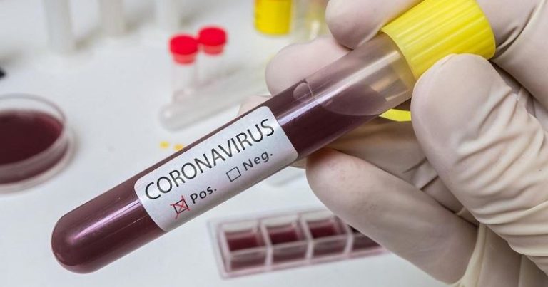 Koronavirusa yoluxanların ümumi sayı artdı