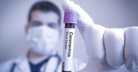 Ulduz qapıçı da koronavirusa yoluxdu – FOTO