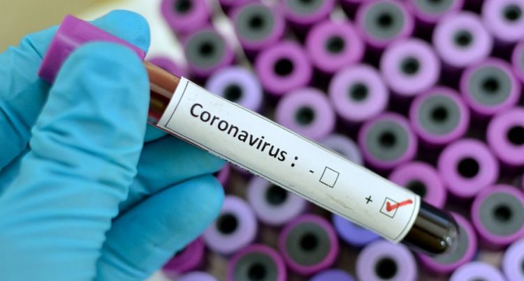 Daha bir ölkədə koronavirus aşkarlandı