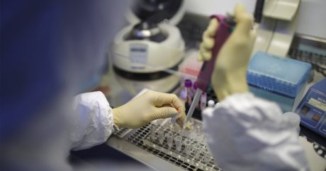 Dünyada koronavirusla bağlı son STATİSTİKA –  ÜST açıqladı