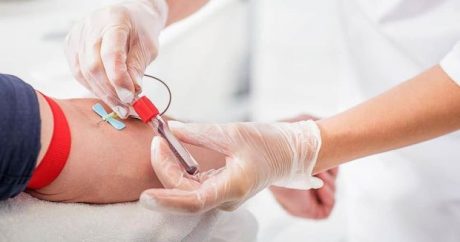 Koronavirus xəstələri üçün kimlər donor ola bilər? – TƏBİB