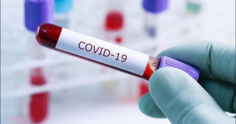 Azərbaycanda daha 76 nəfər koronavirusa yoluxdu – STATİSTİKA