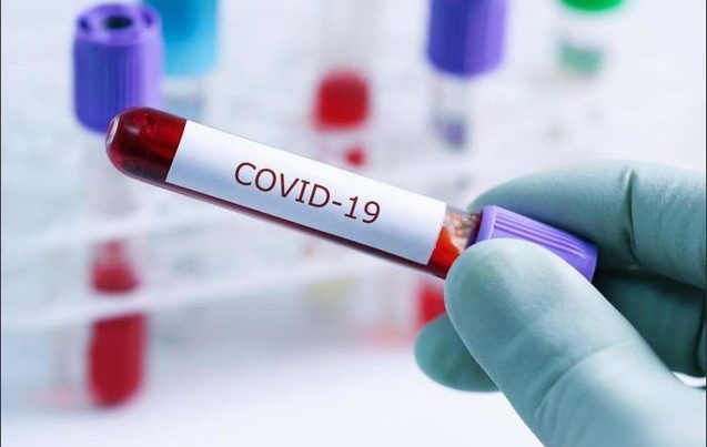 Azərbaycanda COVID-19-a yoluxanların ümumi STATİSTİKA