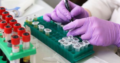 Rusiyadan Azərbaycana təxliyə olunan 33 nəfərdə koronavirus aşkarlandı