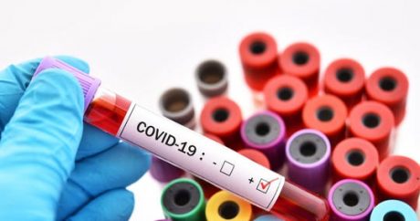 Ermənistanda koronavirusa rekord sayda yoluxma qeydə alındı
