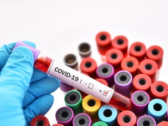 Türkiyədə daha 4 093 nəfər koronavirusa yoluxdu