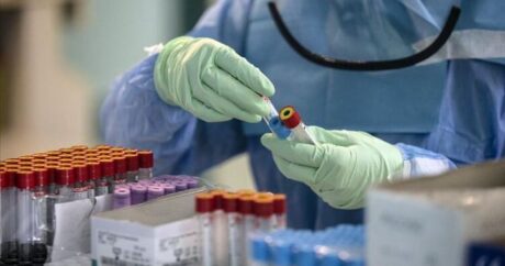 İranda son sutkada 6,2 min nəfər koronavirusa yoluxdu
