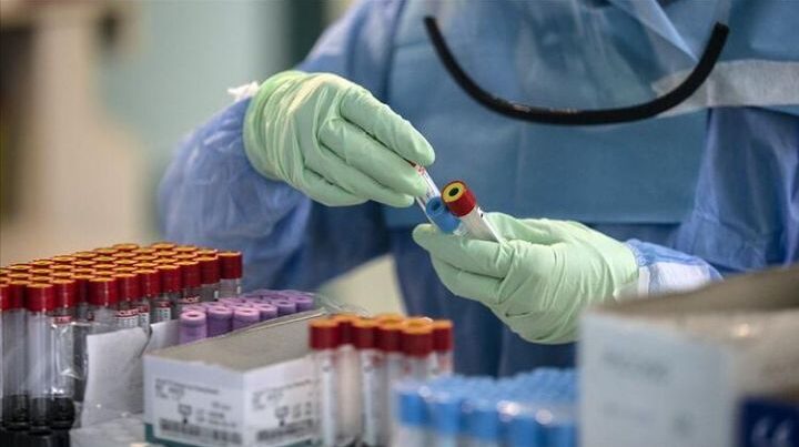 Türkiyədə daha 13 378 nəfər koronavirusa yoluxdu