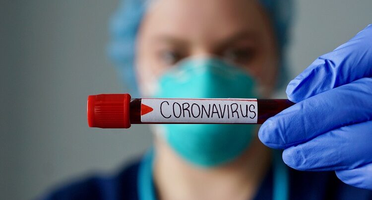 Koronavirusa yoluxanların sayı kəskin azaldı