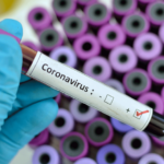 Koronavirusa yoluxanların sayı azaldı