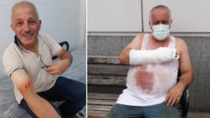 Trabzonda qurban kəsimi: Bələdiyyə başqanı və 126 nəfər yaralandı