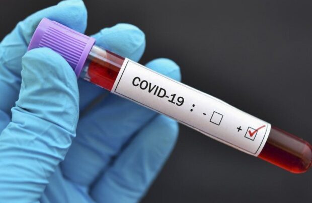 Türkiyədə bu gün koronavirusdan 203 nəfər vəfat etdi