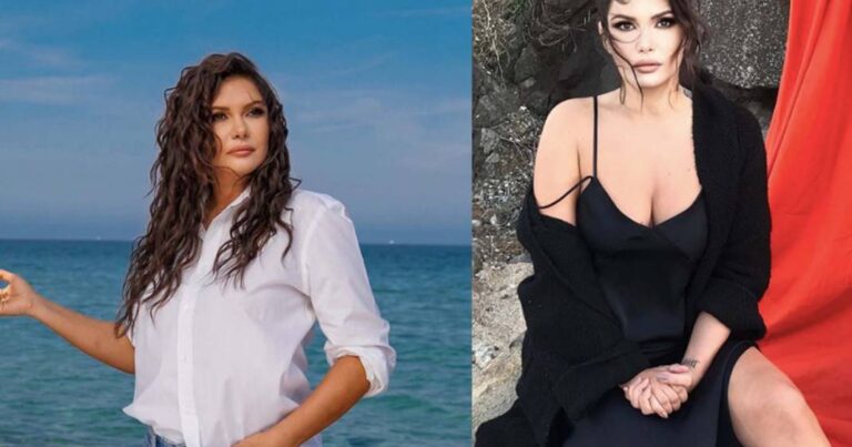 Məşhur modelin üzünü it dişlədi: Tanınmaz hala düşdü – FOTO