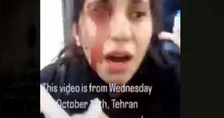 İranda qızın gözünü çıxardılar – VİDEO