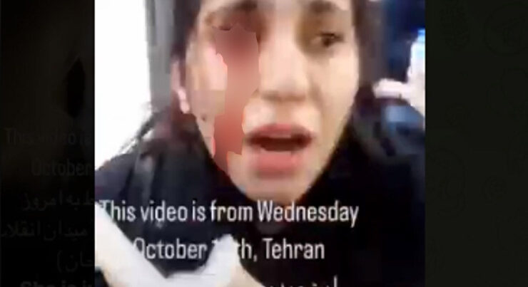 İranda qızın gözünü çıxardılar – VİDEO