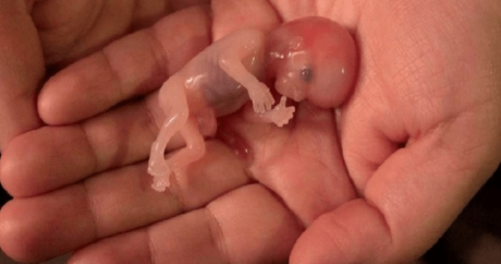 Abort etdirən qadınlara ölüm cəzası veriləcək – QANUN HAZIRLANIR