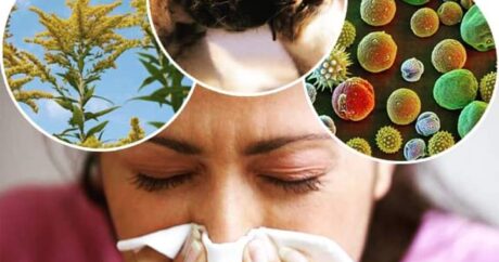 Allergiya, mövsüm dəyişikliyi, qidalar: Nələrə əməl etməli? – Həkimdən TÖVSİYƏLƏR
