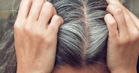 Saçlarımız niyə gənc yaşda ağarır? – ARAŞDIRMA