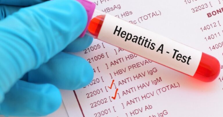 Hepatit A virusunun yayılması ilə bağlı TƏBİB-dən AÇIQLAMA