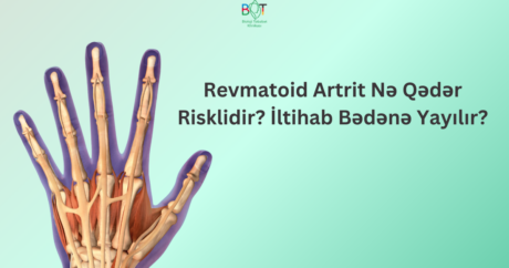 Revmatoid artrit nə qədər risklidir? – İltihab bədənə yayılır?