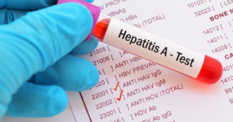 SN: “5-14 yaş qrupu uşaqlar Hepatit A virusuna daha çox yoluxur”