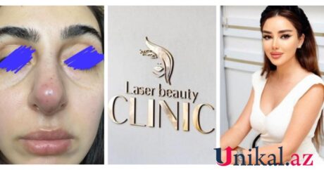 Gözəlləşməyə getdiyi klinikadan xəstə çıxdı: “Laser Beauty Clinic”dən şikayət – FOTO