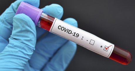 SN: “Azərbaycanda COVID-19-a yoluxma halları olsa da, epidemioloji vəziyyət stabildir”